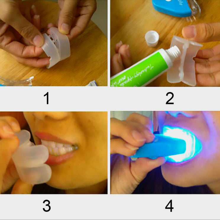 口腔用ジェル、 歯 ホワイトニング、 歯の漂白 LED
