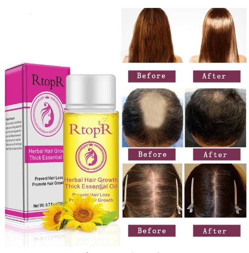 速くて強力な髪の成長製品、エッセンシャルオイル液体治療、脱毛防止、ヘアケア