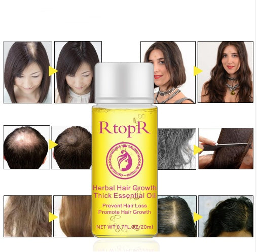 速くて強力な髪の成長製品、エッセンシャルオイル液体治療、脱毛防止、ヘアケア