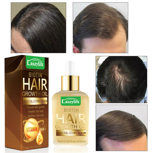 ヘアケアエッセンシャルオイル 30m、 ソフトで爽やか